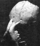 Early hominid skull with distinctive puncture marks found in a cave at Swarkrans in the late 1930s.